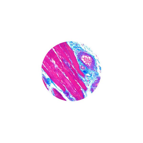 Trichrome Stain Kit